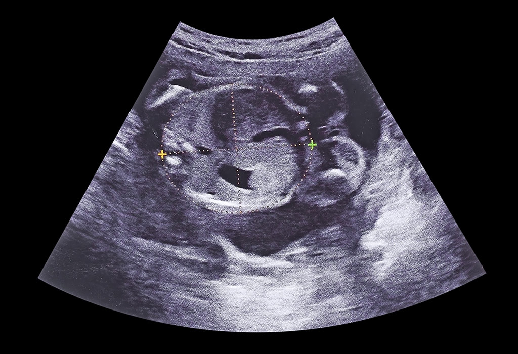 19 Weeks Ultrasound
