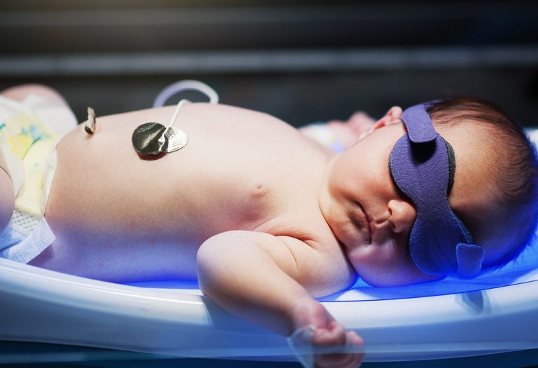 नवजात शिशुओं में पीलिया के लिए उपचार के विकल्प