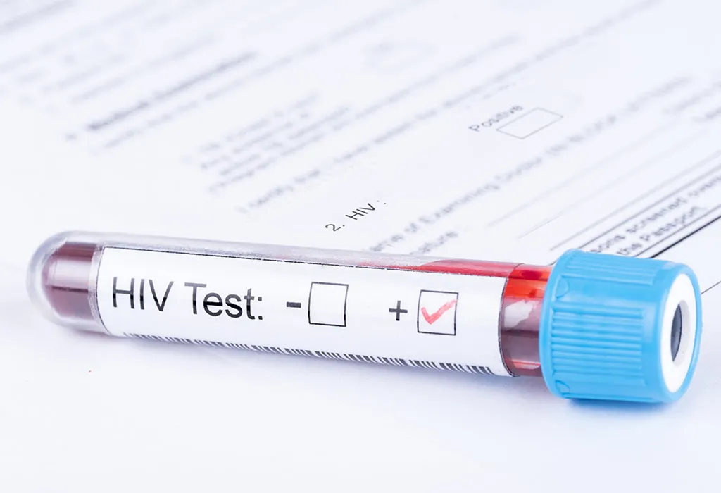 एचआईवी टेस्ट कैसे होता है?