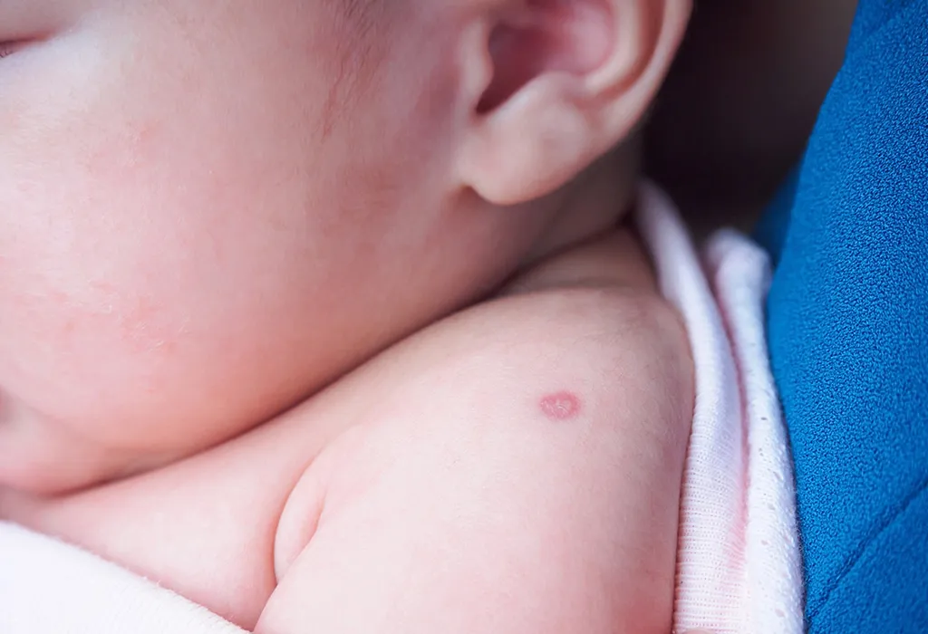न्यूबॉर्न बेबी में वैक्सीनेशन के साइड इफेक्ट