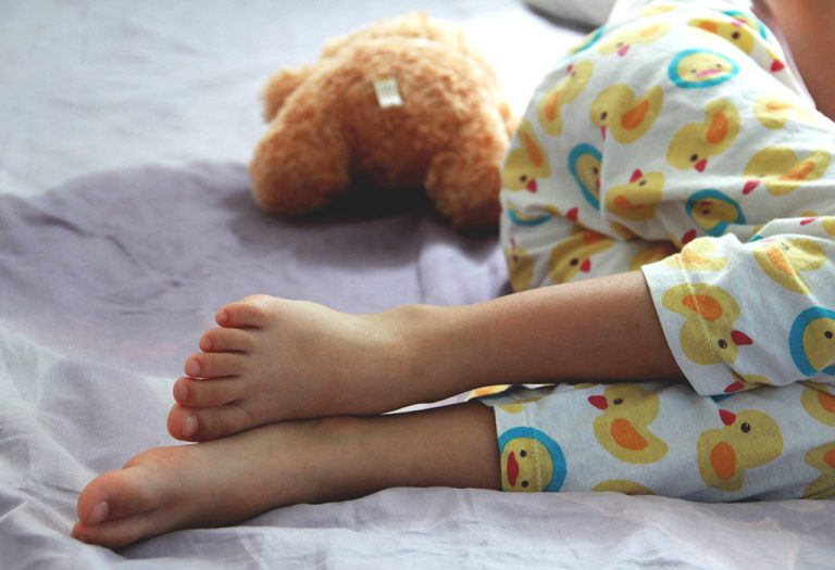 Bedwetting (Nocturnal Enuresis) in Children