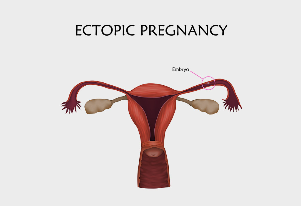 egg white cervical mucus with brown tinge