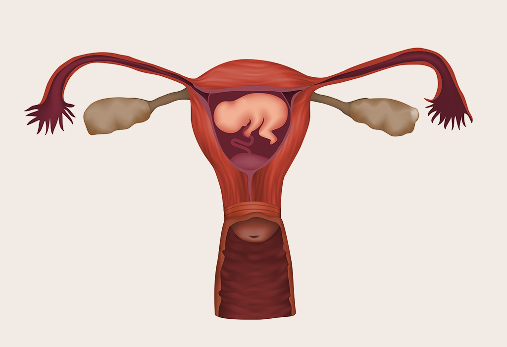 Does Placenta Previa Cause Preterm Delivery