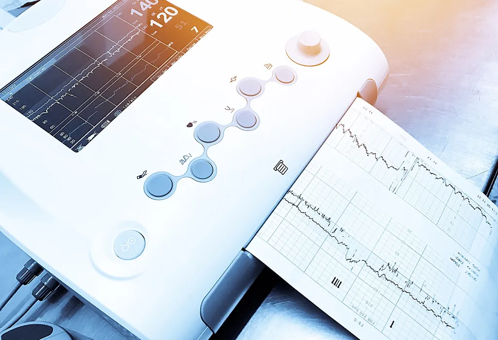 Non-Stress Test (NST) or Cardiotopograph (CTG)