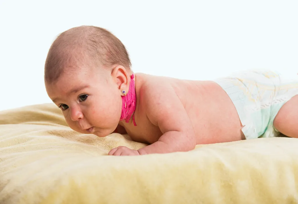 klippel feil syndrome infant
