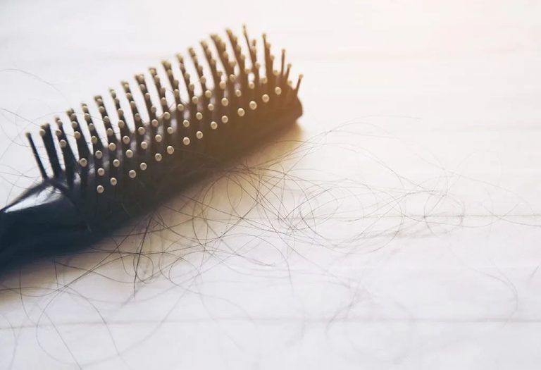 Hair Loss in Children - Causes, Diagnosis and Treatments
