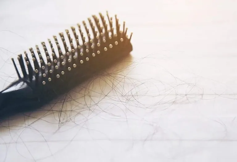 Hair Loss in Children - Causes, Diagnosis and Treatments
