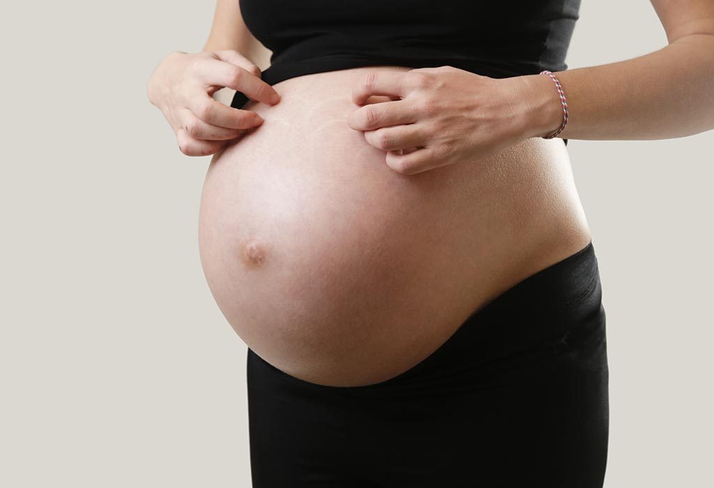 does your belly button itch when your pregnant