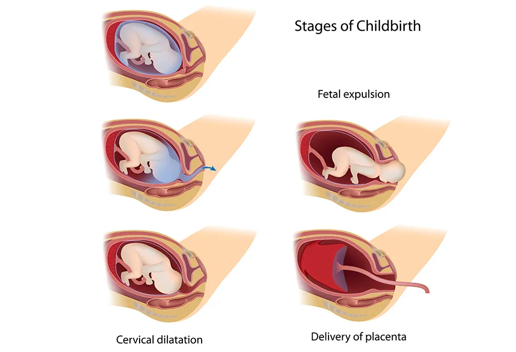 Stages of Childbirth