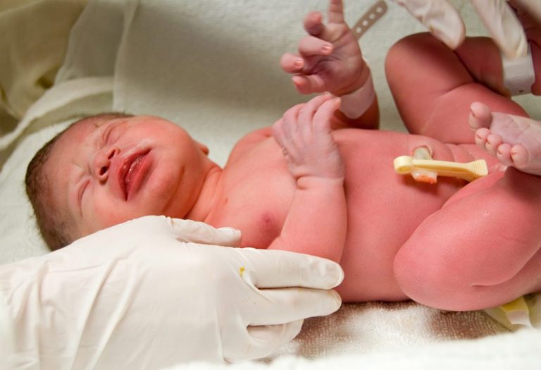 Apgar Score: Chart, Meaning, & Normal Range