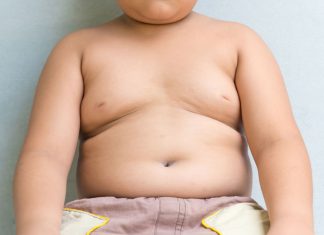 बच्चों में मोटापा