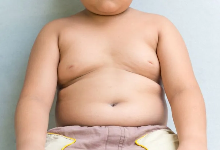 Obesity in Children