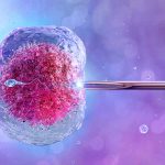 A Guide to Zygote Intrafallopian Transfer (ZIFT) – Infertility Treatment