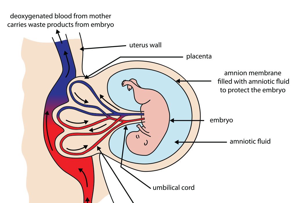 causes low amniotic fluid