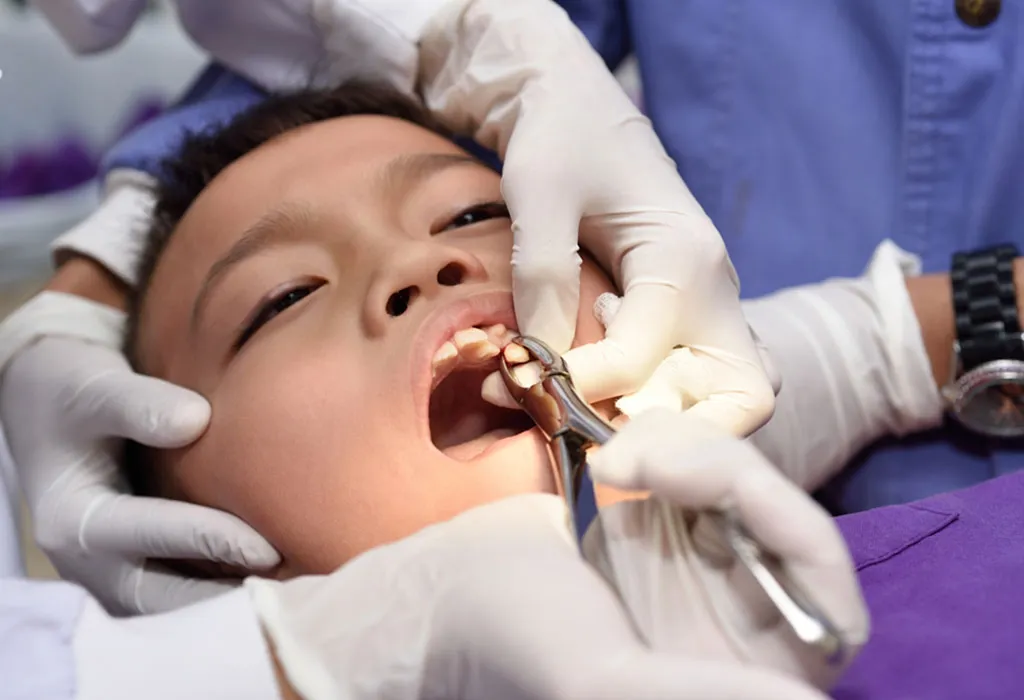 Dental extraction of a boy