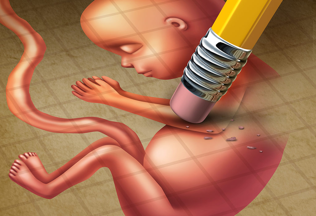 कृत्रिम गर्भपात तथा इसके दुष्प्रभाव