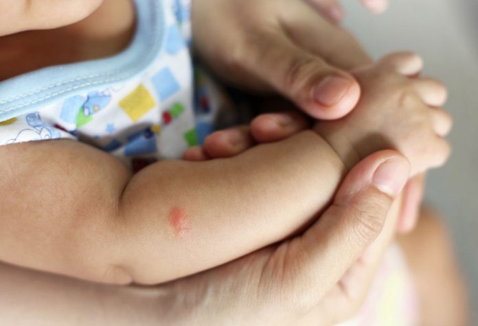 शिशुओं को मच्छर काटना  - कारण और उपचार