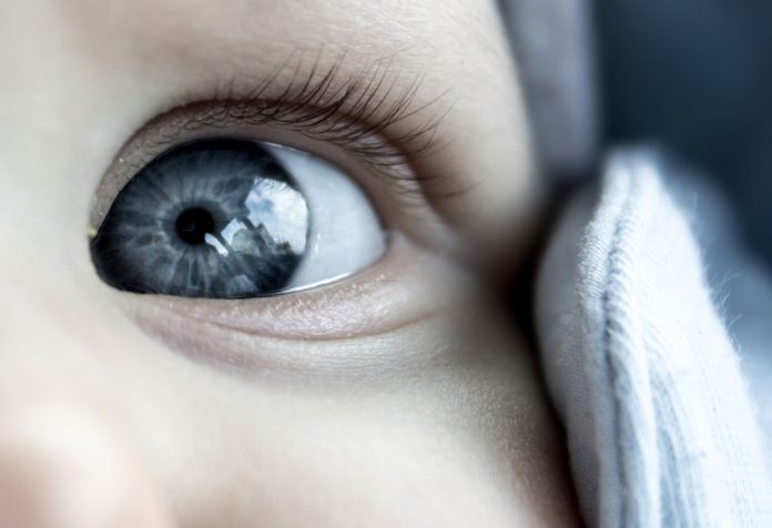 How to Deal with Congenital Nystagmus in Babies