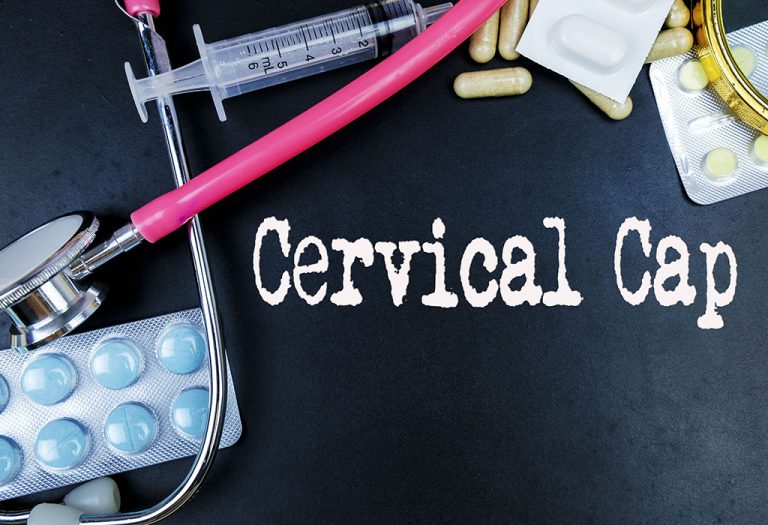 Cervical Cap - A Birth Control Method