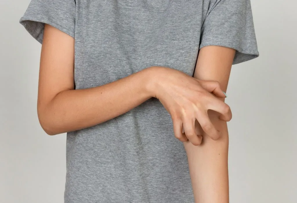 Scabies in Children: Causes, Symptoms & Treatment