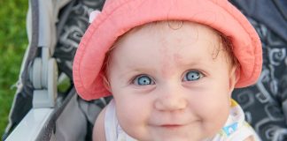 नवजात शिशु में पैदाइशी निशान: कारण, प्रकार और उपचार