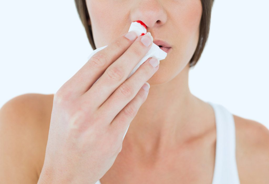 Nosebleeds During Pregnancy – When Should You Worry?