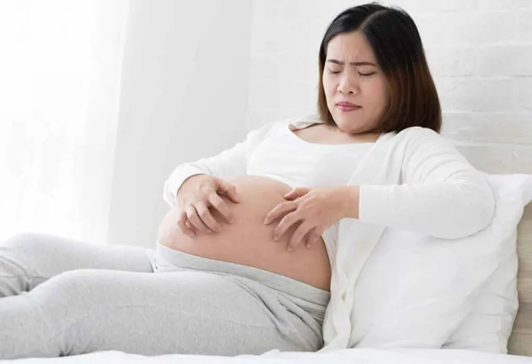Itching During Pregnancy: Causes, Treatments and Home Remedies