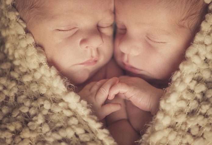 Conjoined Twins - Types, Causes, Signs & Treatment