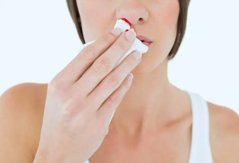 Nosebleeds in Pregnancy - Causes and How to Stop It