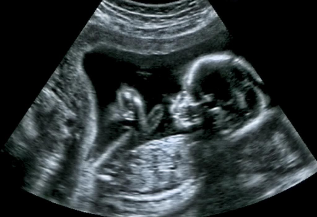 Helps a Baby in the Womb