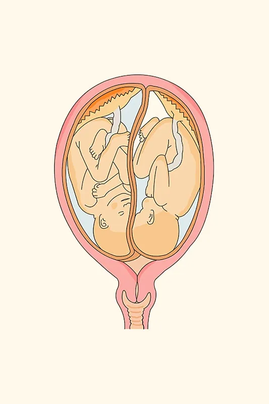 Having More Than One Foetus (Twins or Multiples)