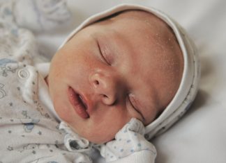 बच्चों में क्रैडल कैप का इलाज करने के लिए 15 आसान और प्रभावी प्राकृतिक उपचार बच्चों में क्रैडल कैप होना