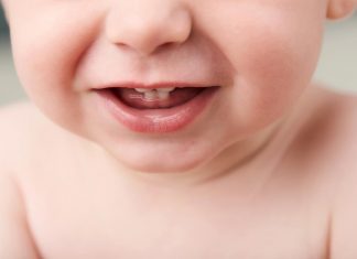 दांत के साथ जन्म लेने वाले बच्चे दांत के साथ जन्म लेने वाले बच्चे
