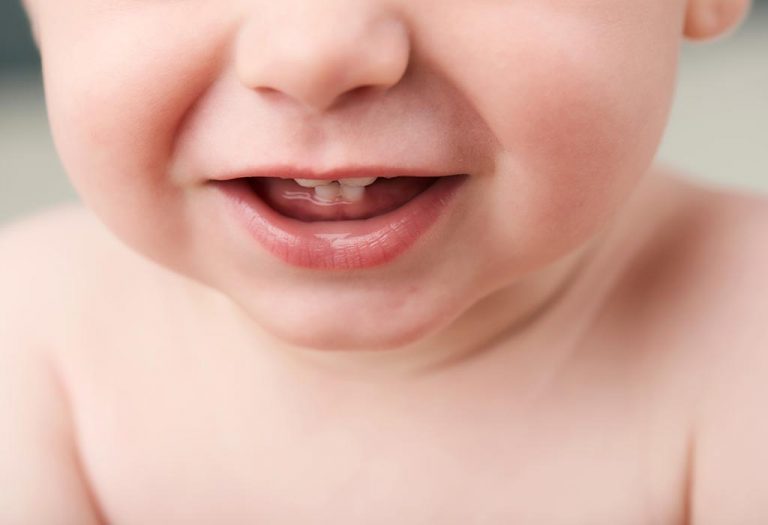 Baby Born With Natal Teeth