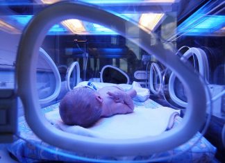 নবজাতকের জন্ডিসের জন্য শীর্ষ 10টি ঘরোয়া প্রতিকার