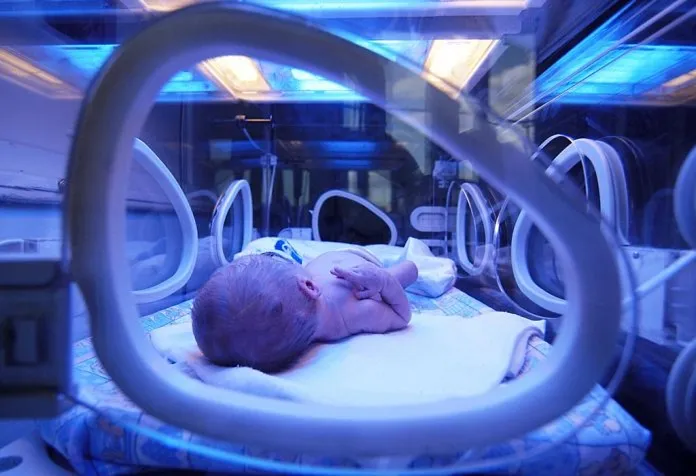 10 Home Remedies for Jaundice in Newborns
