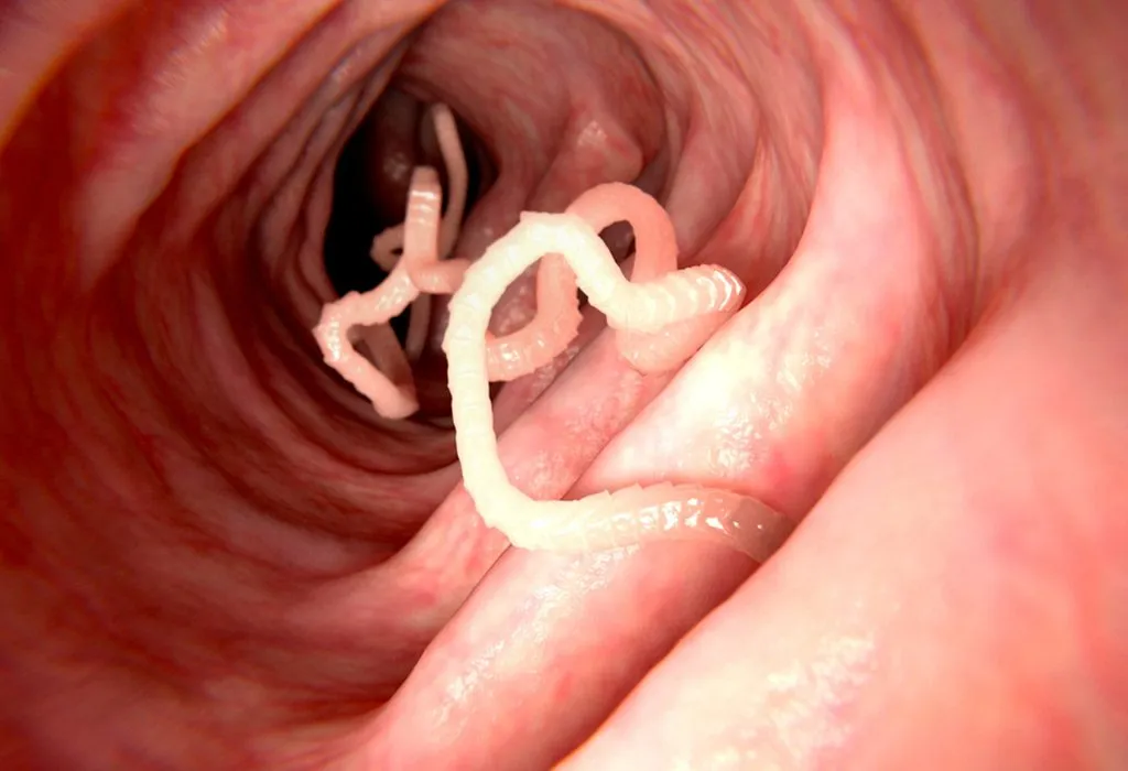 pin worms in humans