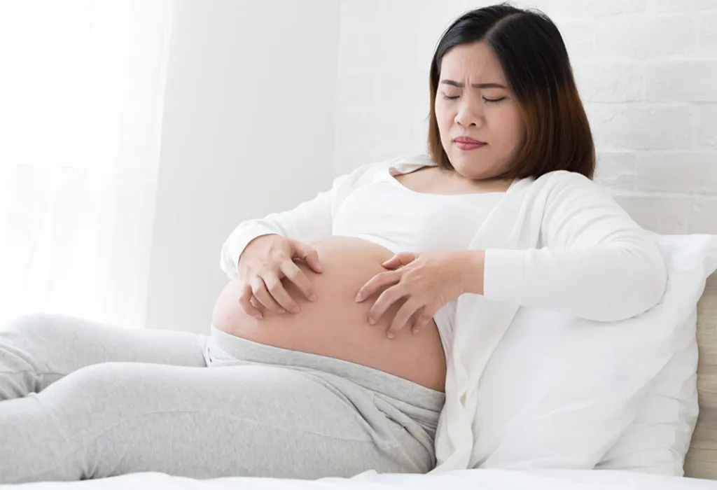 Heat Rash During Pregnancy