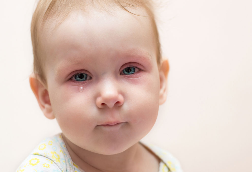 Baby Eye Infections Types Signs Causes Home Remedies