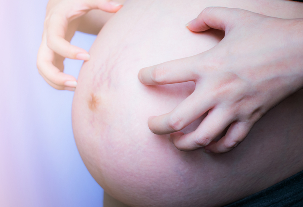 is-it-normal-to-itch-all-over-in-pregnancy-macarthur-medical-center