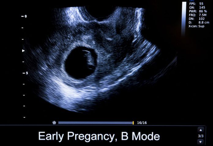 baby measuring small at 9 weeks