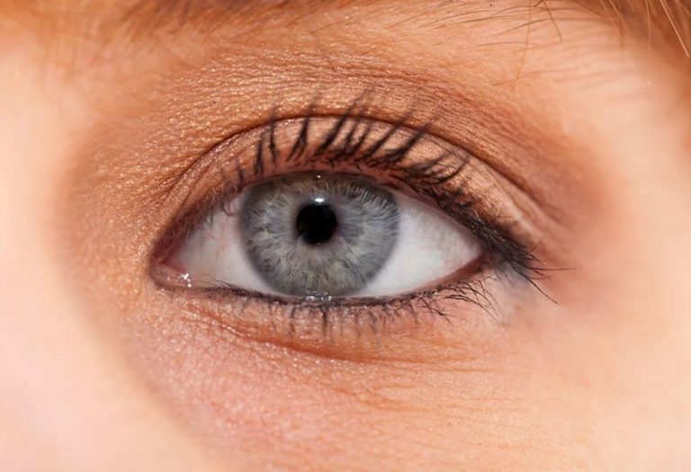 Dark Circles Under Eyes in Kids - Causes and Treatment