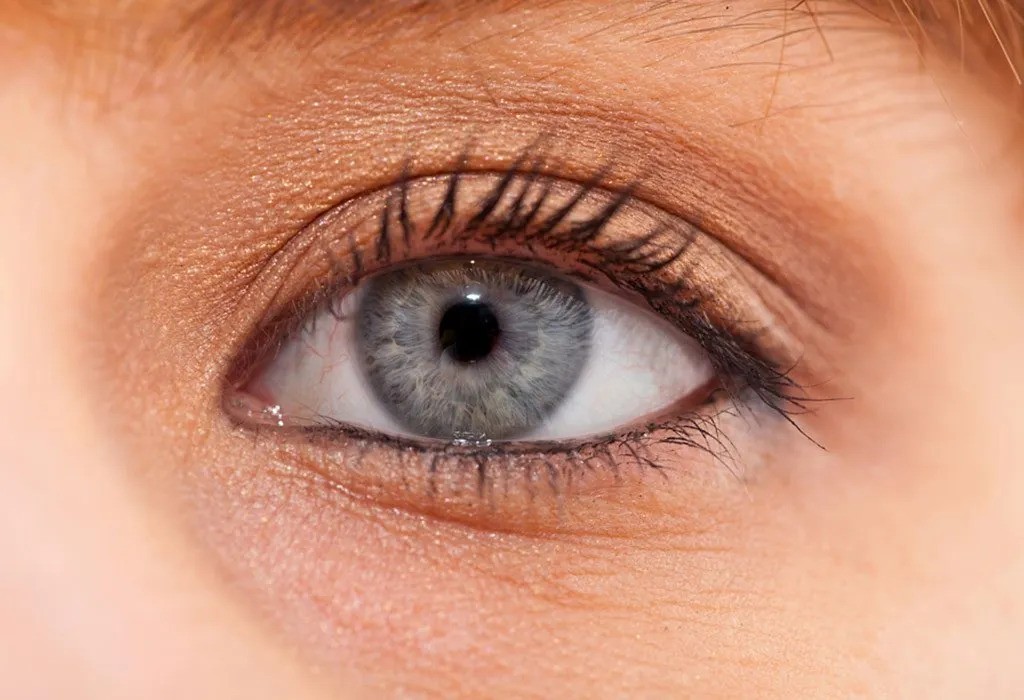 Dark Circles Under Eyes in Kids – Causes and Treatment