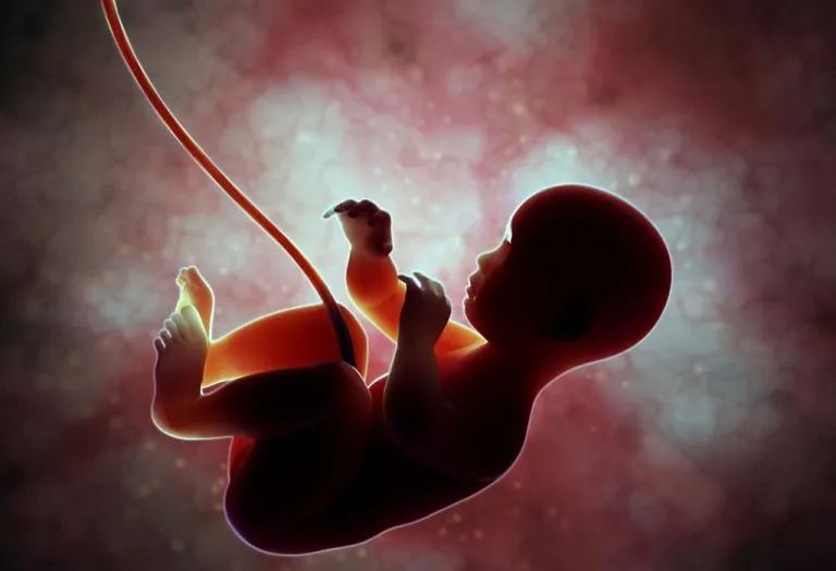 Delayed Cord Clamping
