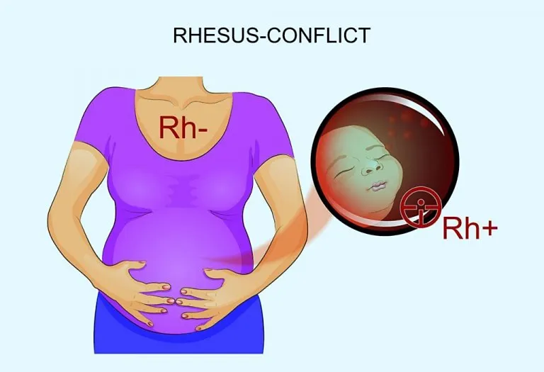 Rh Factor and Antibody Screening Test in Pregnancy