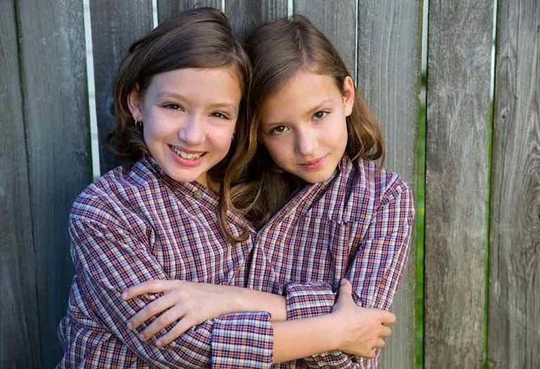 Conjoined Twins (Siamese Twins) - Types, Causes and Symptoms