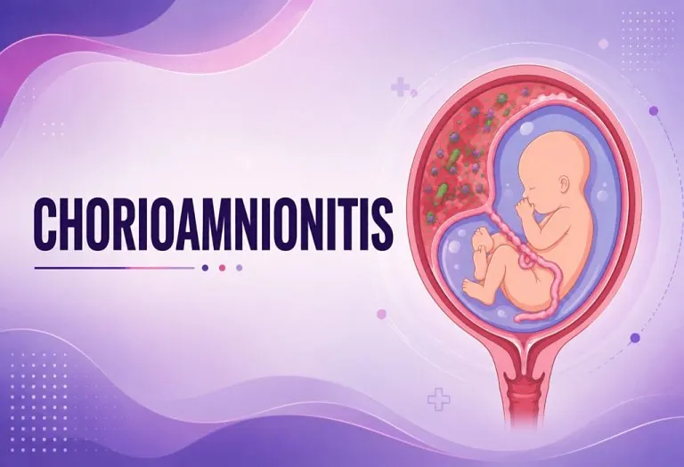 Chorioamnionitis - Causes, Symptoms, and Prevention