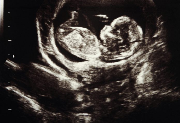 Signs of a Healthy and Unhealthy Baby in the Womb