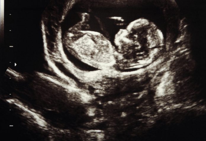 small baby in utero