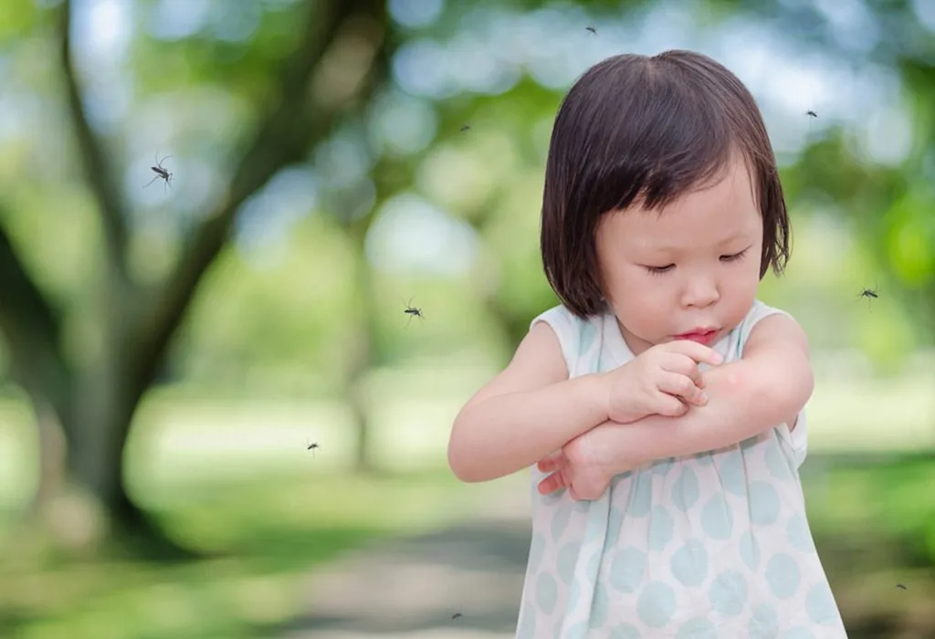 10 Home Remedies for Mosquito Bites in Babies